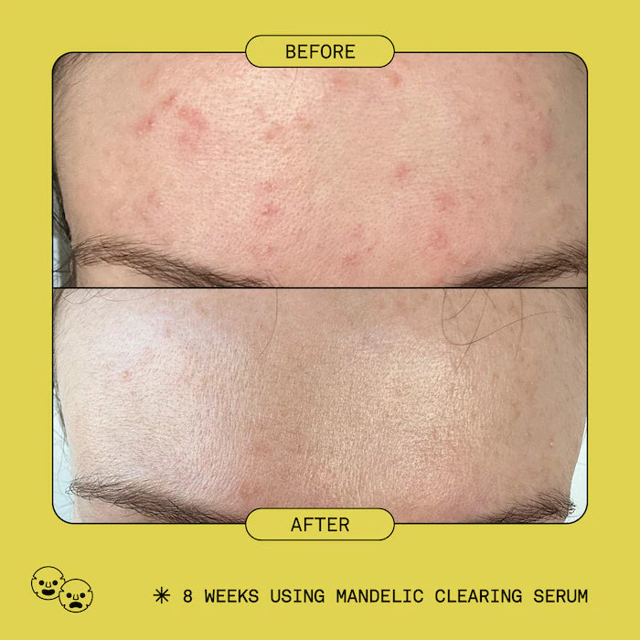 Mandelic Acid Exfoliating Clearing Serum 3ML