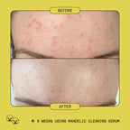 Mandelic Acid Exfoliating Clearing Serum 3ML