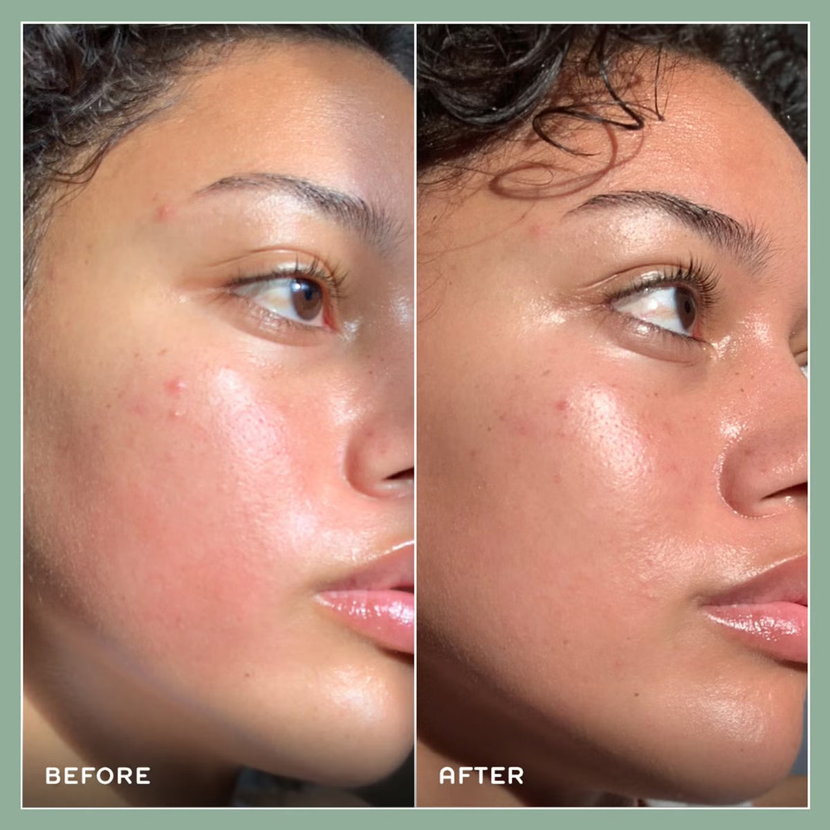 REN Clean Skincare Evercalm Redness Relief Serum