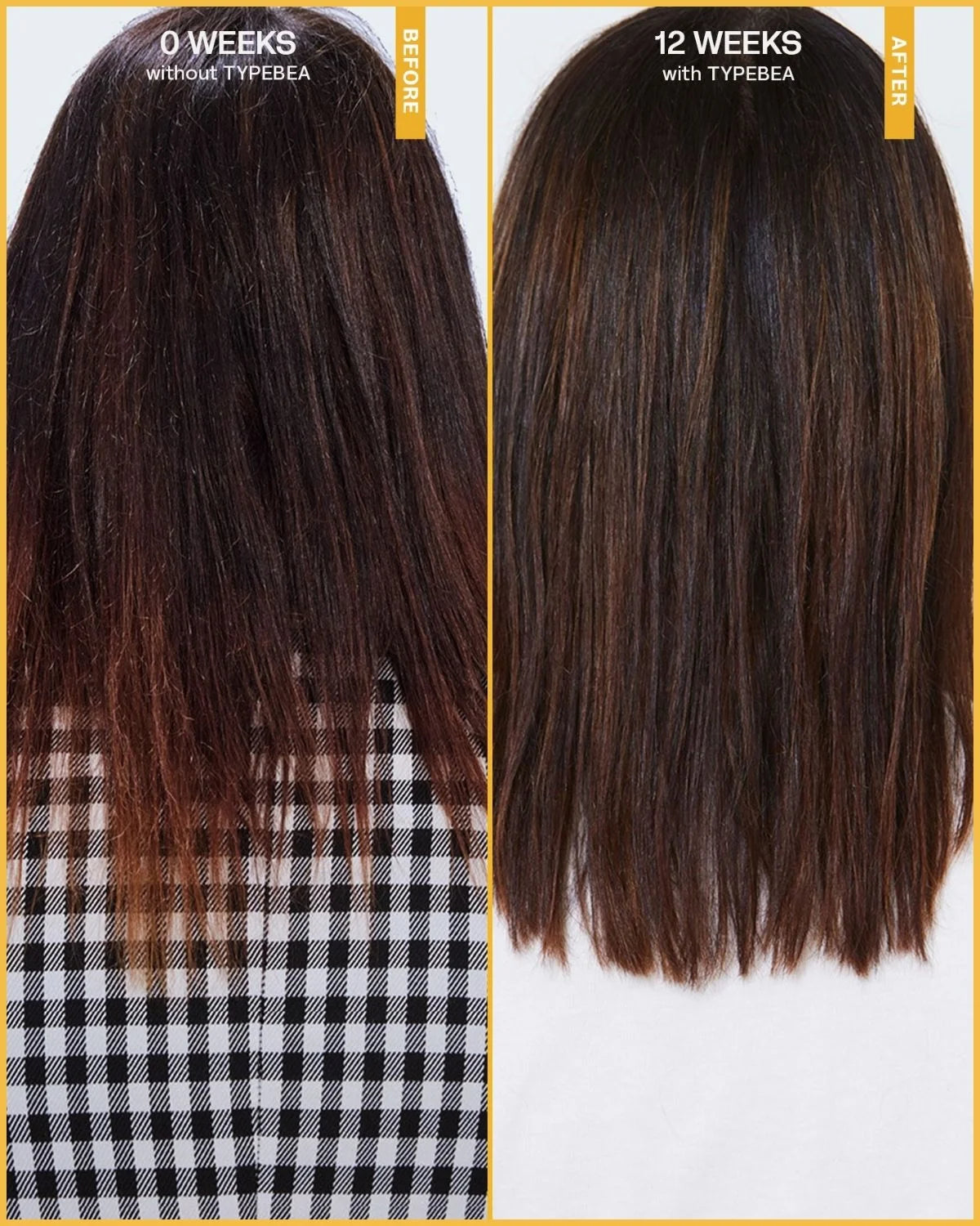 TYPEBEA G•1 Overnight Boosting Peptide Hair Growth Serum