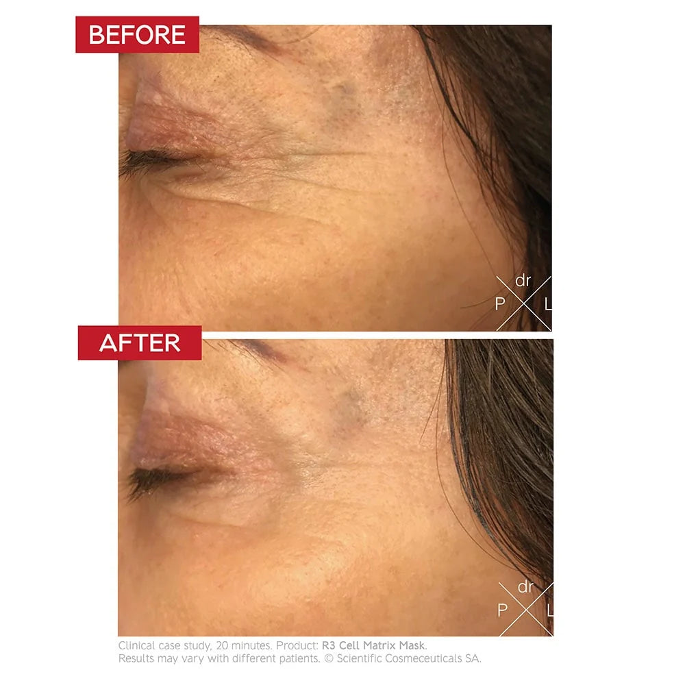Dr. LEVY Switzerland R3 Cell Matrix Mask