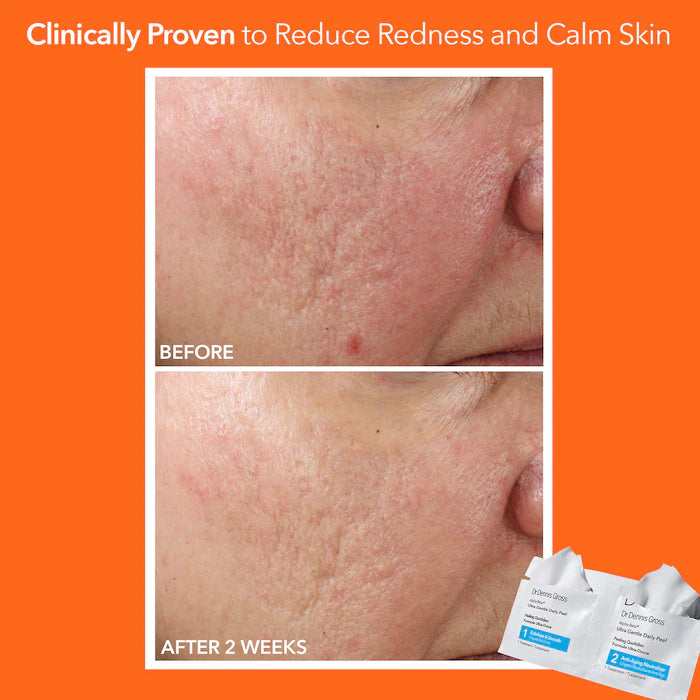 Dr. Dennis Gross Alpha Beta Ultra Gentle Daily Peel