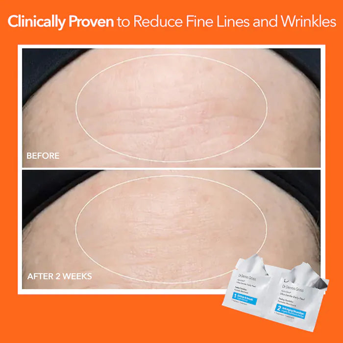 Dr. Dennis Gross Alpha Beta Ultra Gentle Daily Peel