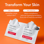 Dr Dennis Gross Alpha Beta Extra Strength Daily Peel