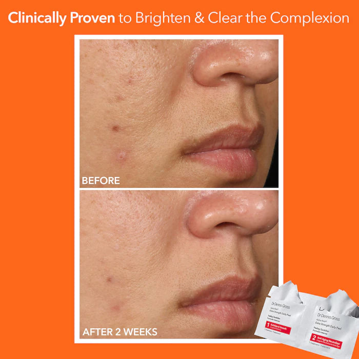 Dr Dennis Gross Alpha Beta Extra Strength Daily Peel