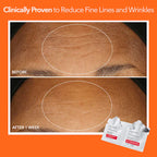 Dr Dennis Gross Alpha Beta Extra Strength Daily Peel