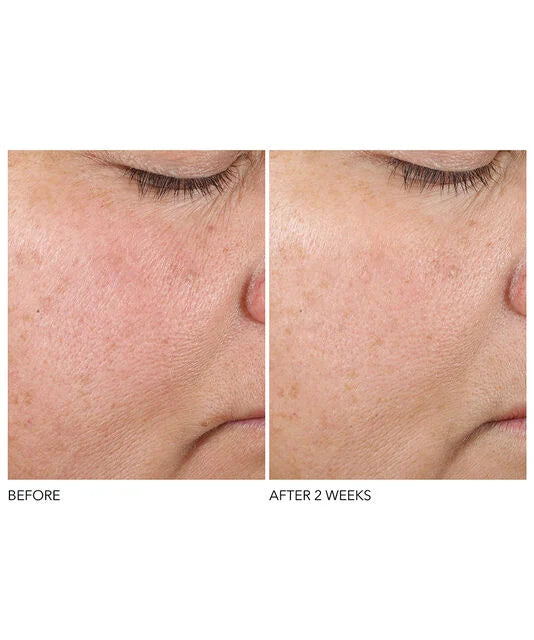 Dr Dennis Gross Advanced Retinol + Ferulic Texture Renewal Serum