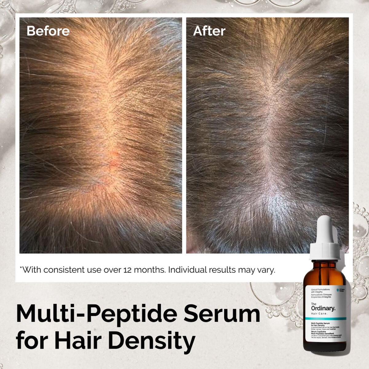 The Ordinary Multi-Peptide Serum for Hair Density - 60ml - image 5