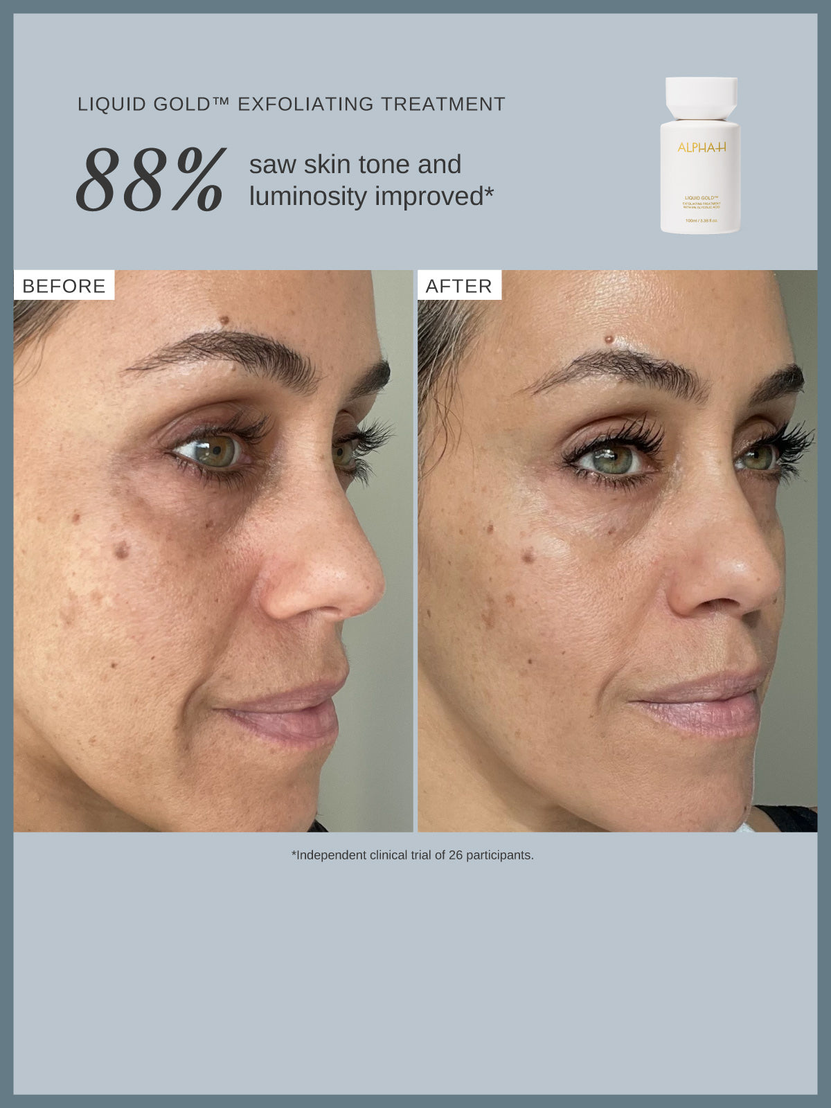 Alpha-H Liquid Gold Exfoliating Treatment - 100ml — official source image
