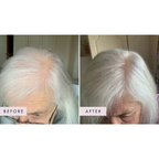 Hair Gain Gummies - 60 Gummies — official source image