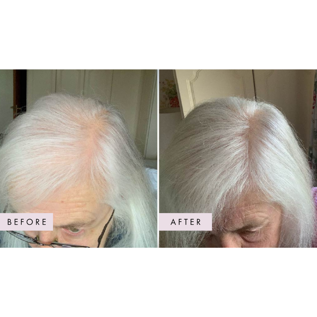 Hair Gain Gummies - 60 Gummies — official source image