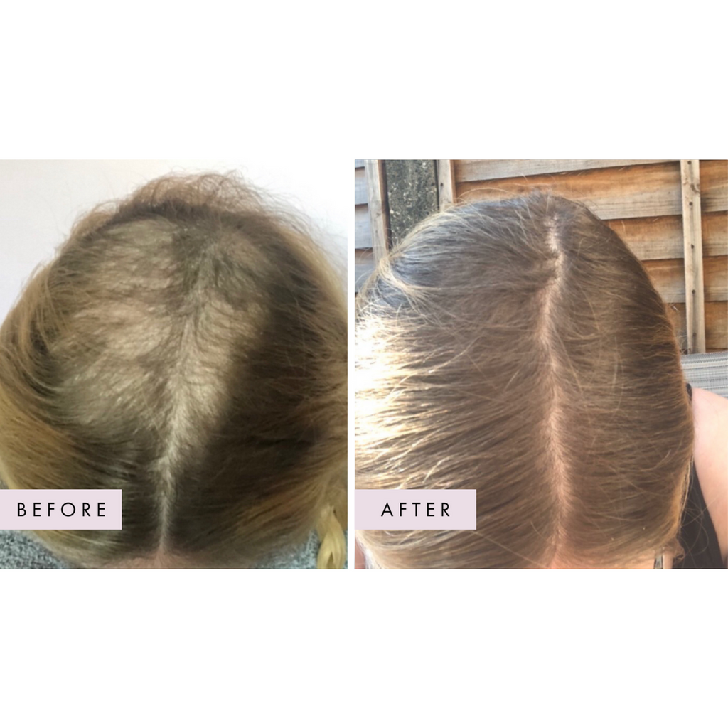 Hair Gain Gummies - 60 Gummies — official source image