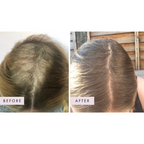 Hair Gain Gummies - 60 Gummies — official source image