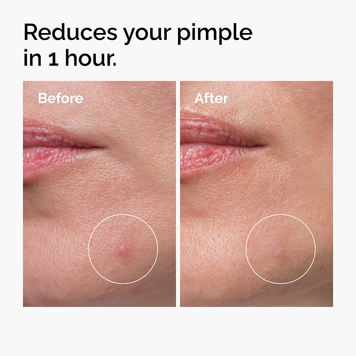 The Ordinary Sulfur 10% Powder-to-Cream Concentrate - 5g - image 4