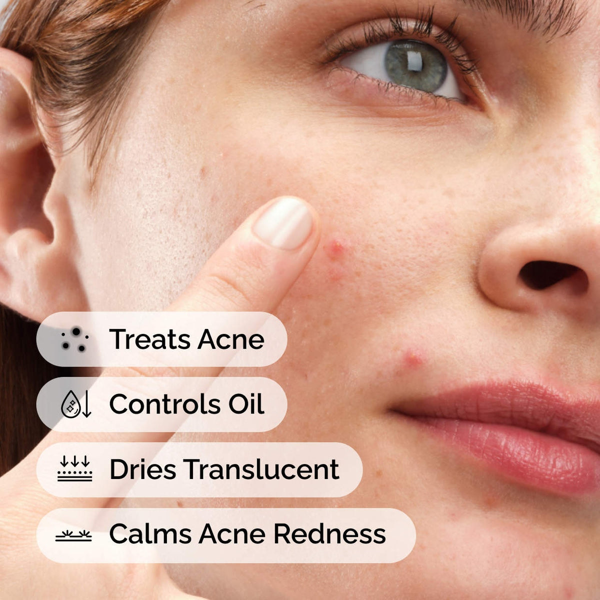 The Ordinary Sulfur 10% Powder-to-Cream Concentrate - 5g - image 5
