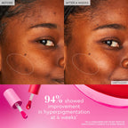 Glow Recipe Watermelon Glow Niacinamide Dewy Flush — Cherry Flush