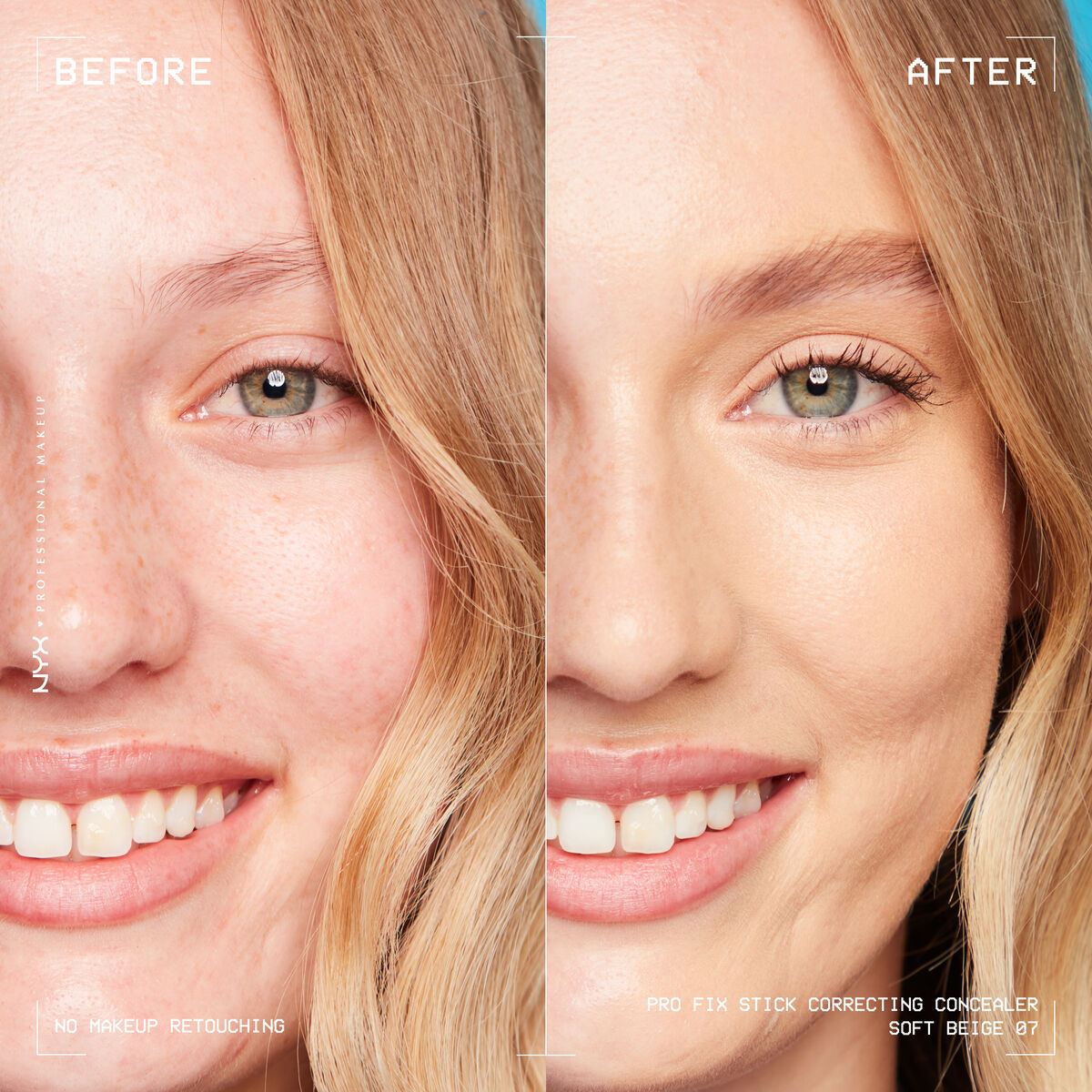 NYX Professional Makeup PRO FIX STICK CORRECTING CONCEALER 07 SOFT BEIGE 0800897249403 BeforeAfter Camryn 01.jpg
