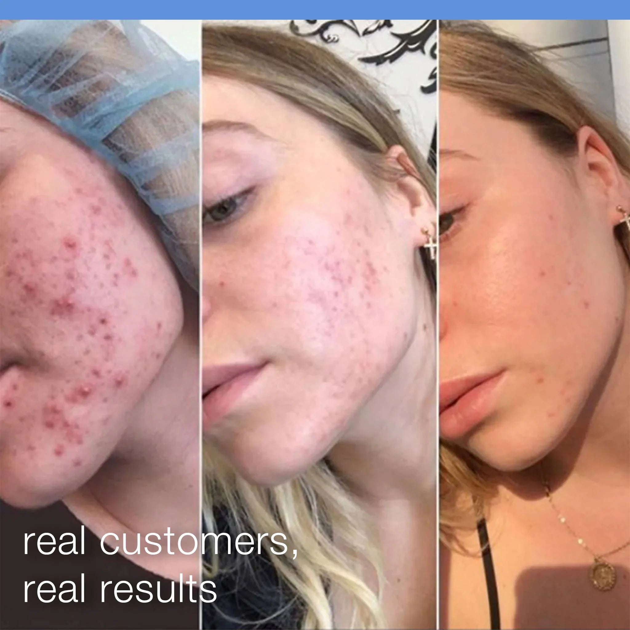 Exfoliante Microfoliante Diario Recargable