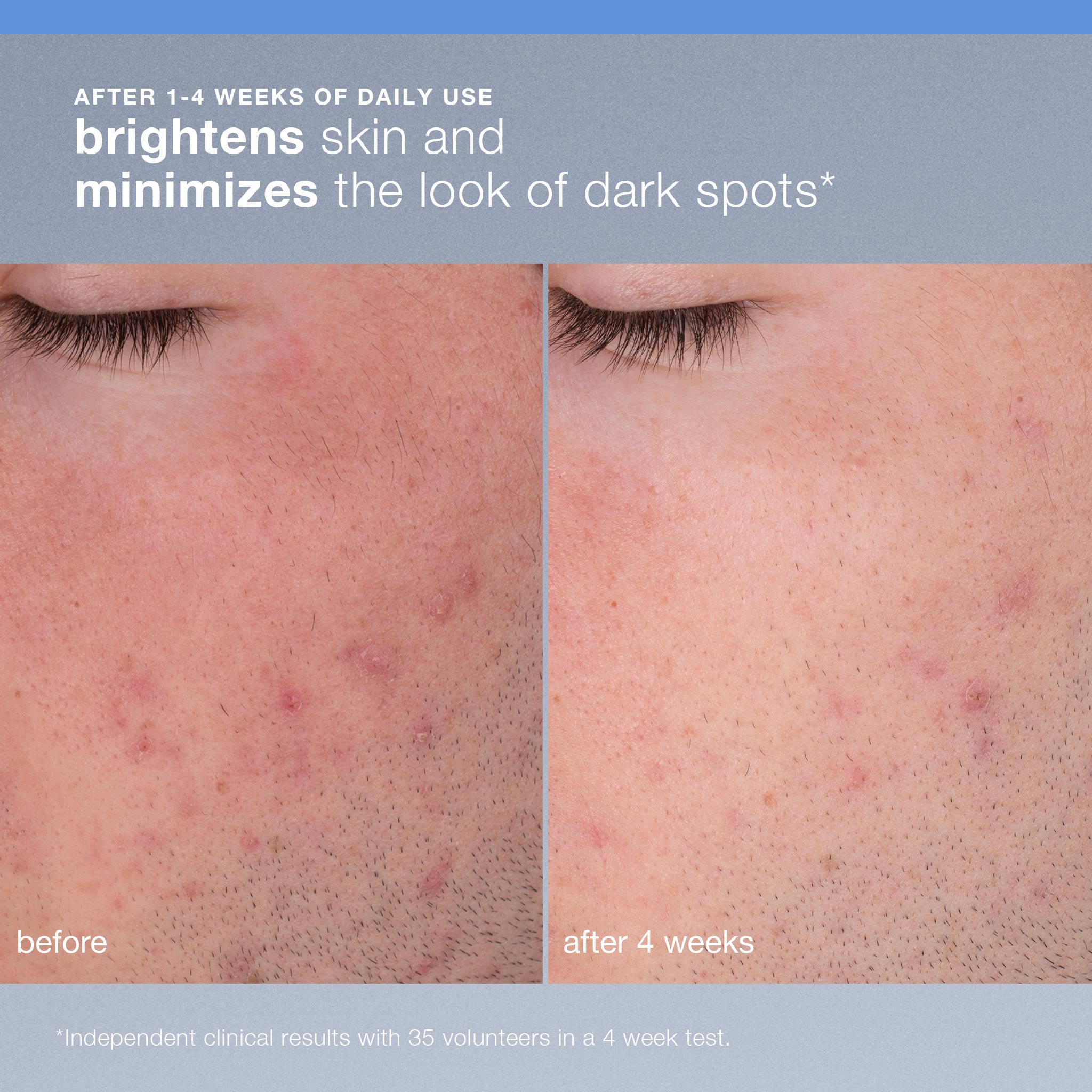 Exfoliante Microfoliante Diario Recargable