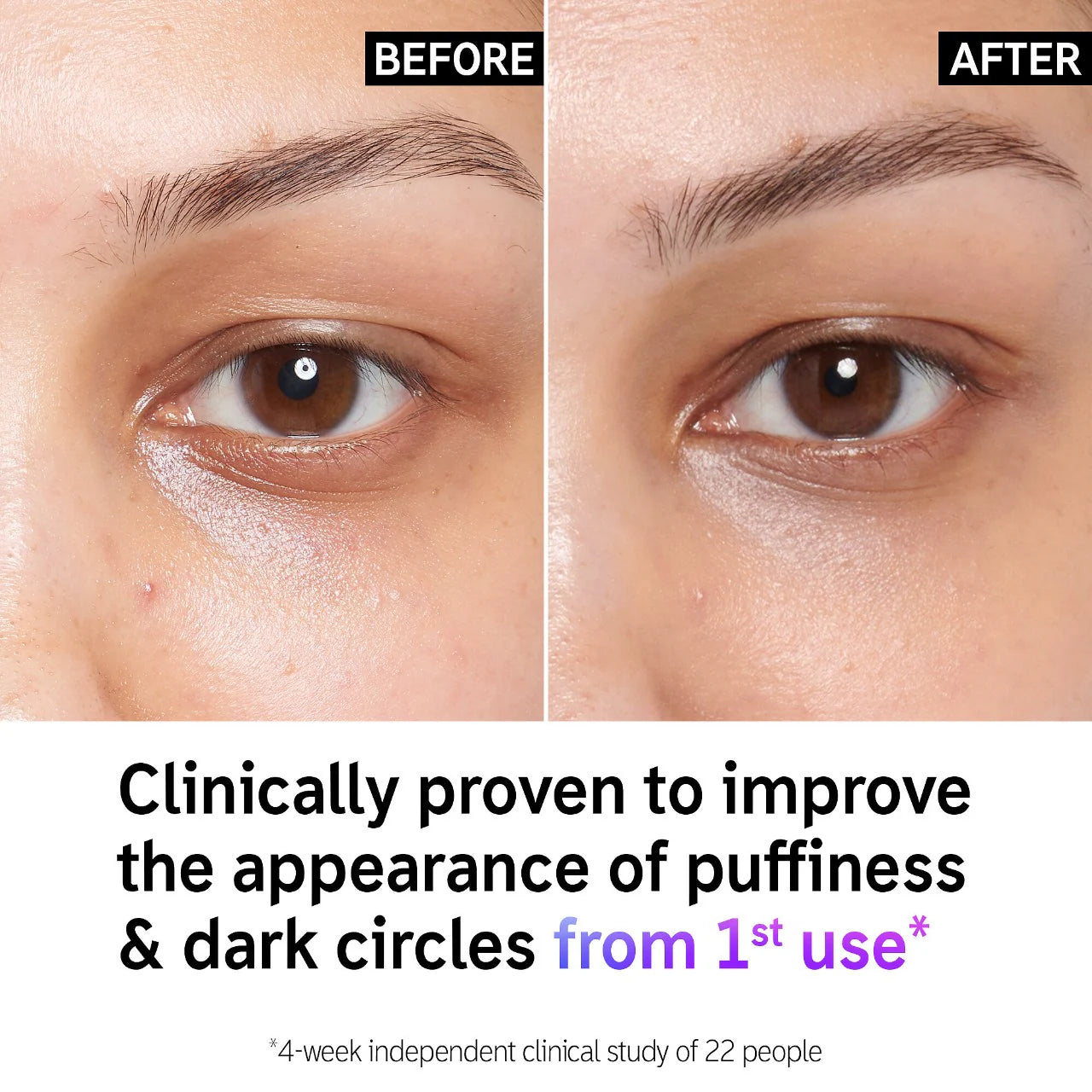 Crema para ojos antihinchazón y ojeras con cafeína