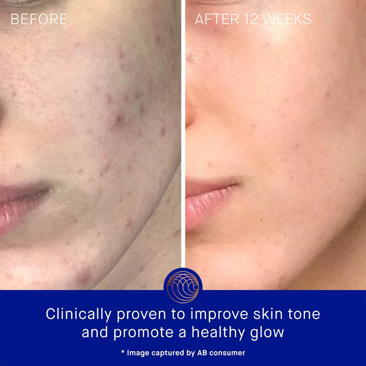 The Cream with TFC8® Face Moisturizer
