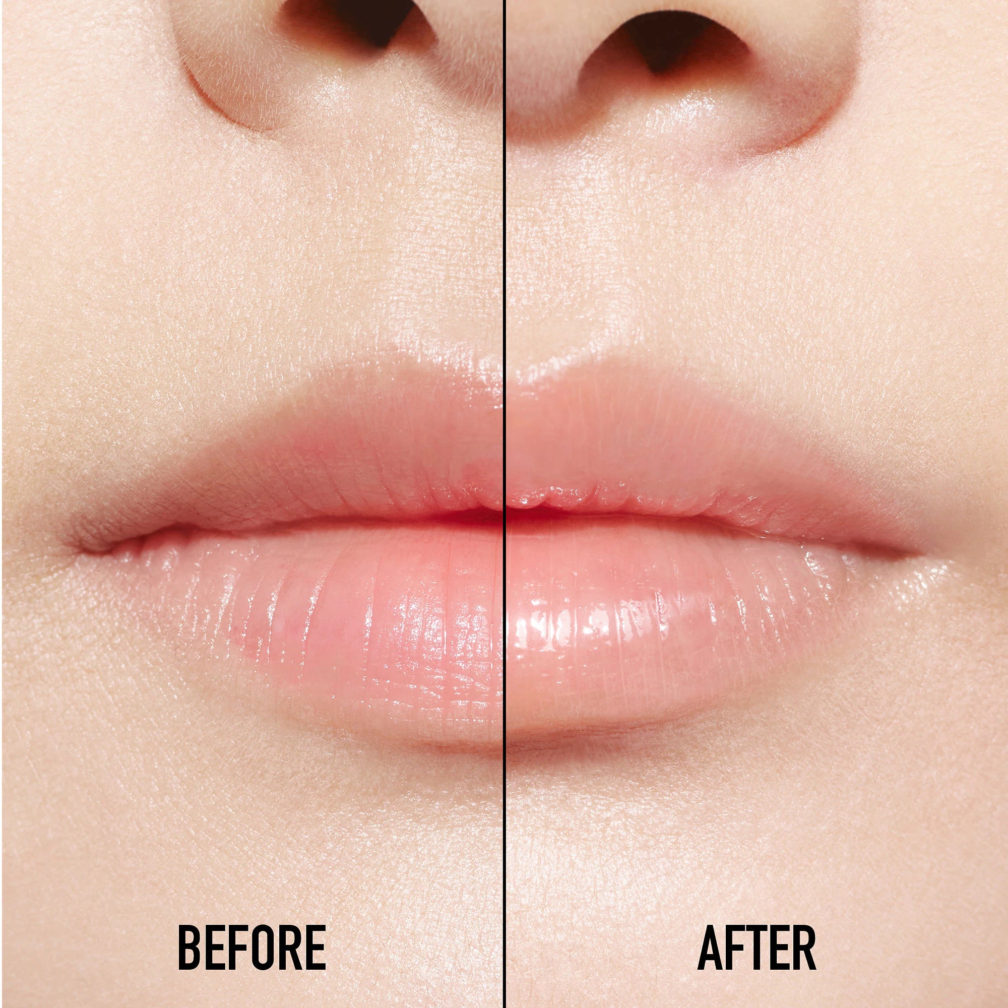 Suero Lip Maximizer