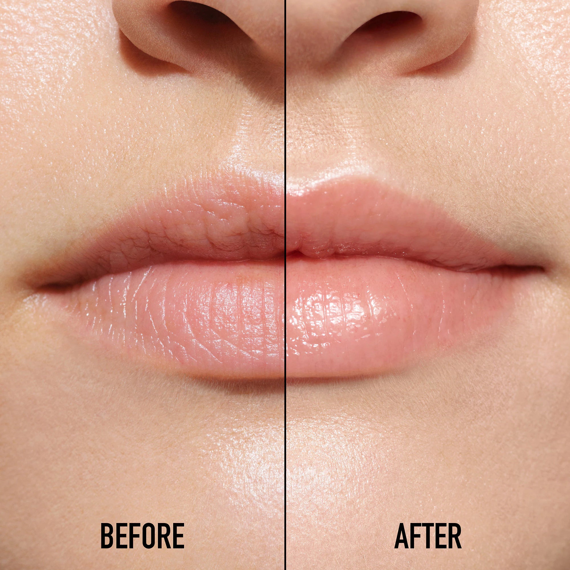 Suero Lip Maximizer