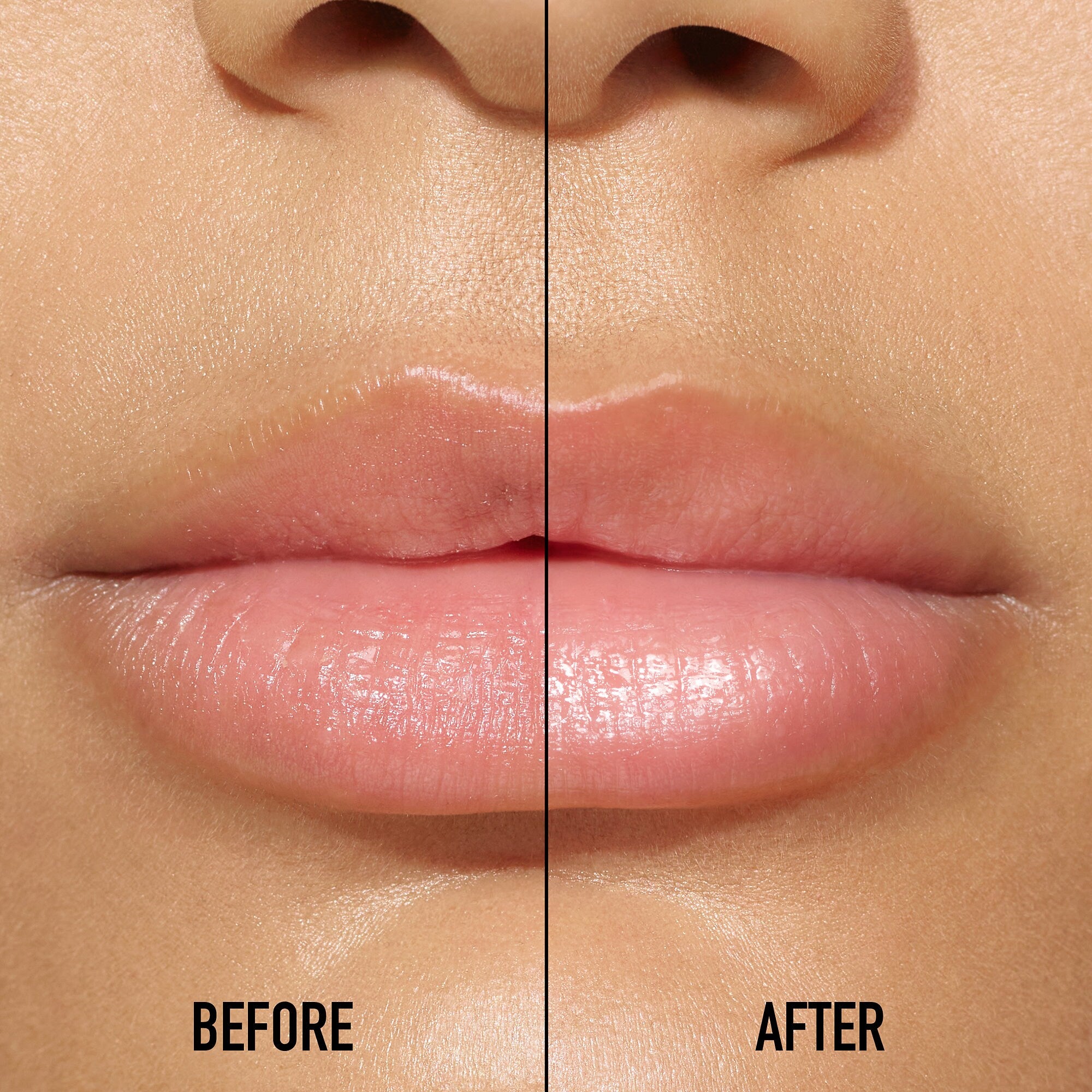 Suero Lip Maximizer