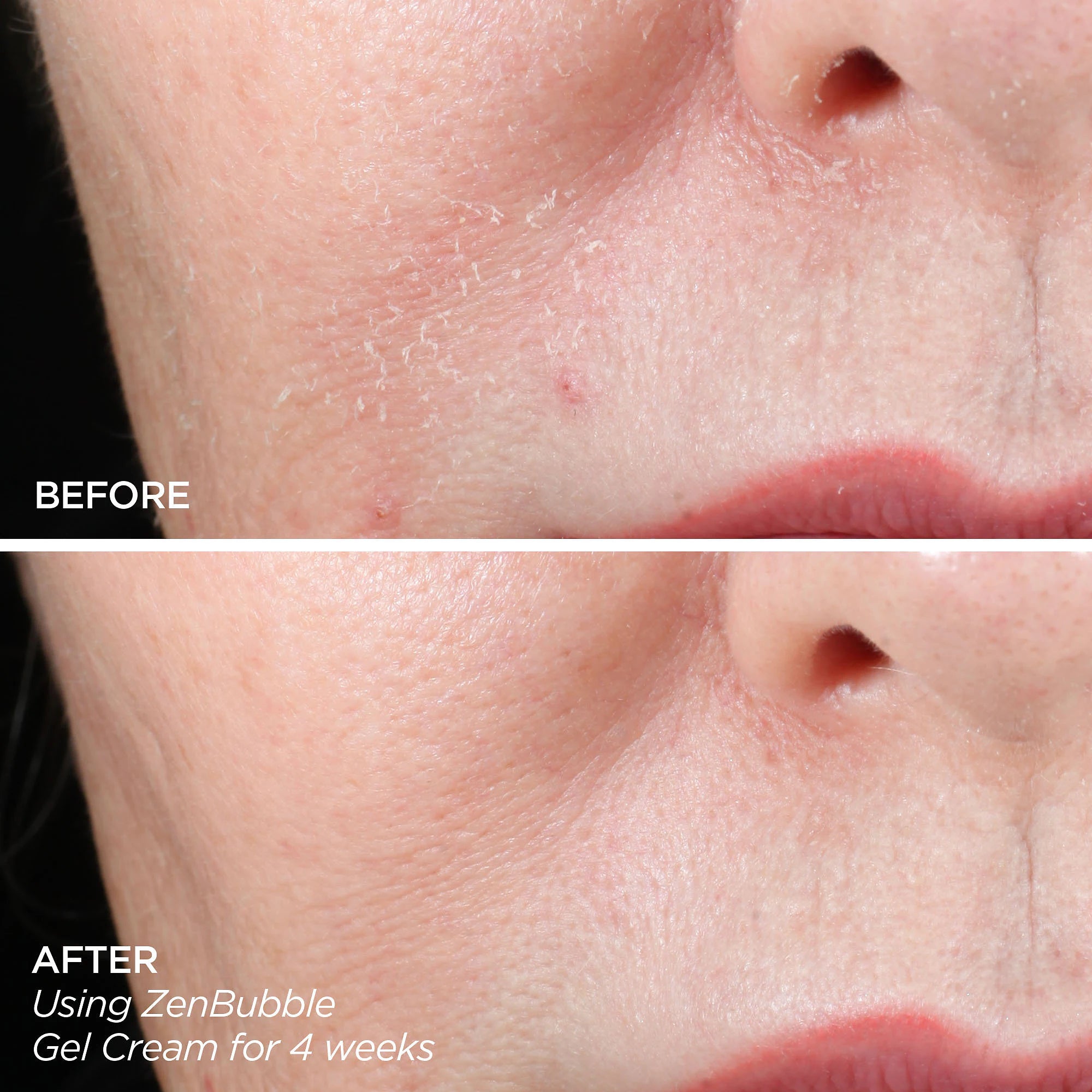 Consigue ese brillo - Kit de herramientas de microagujas y descubrimiento GloPRO®