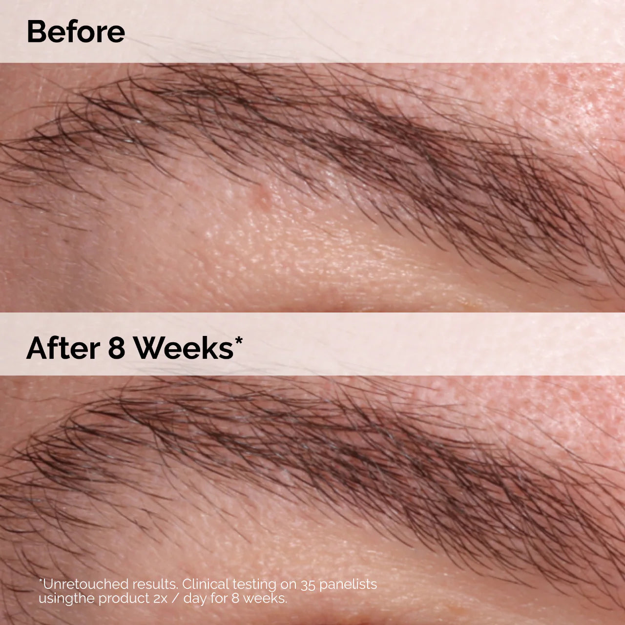 Multi-Peptide Lash and Brow Serum
