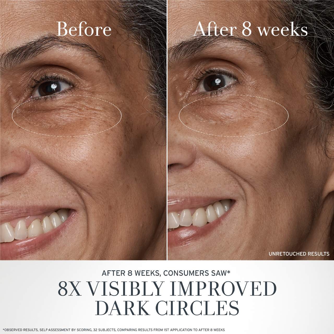 Black Tea Anti-Aging Eye Cream with Retinol-Alternative BT Matrix