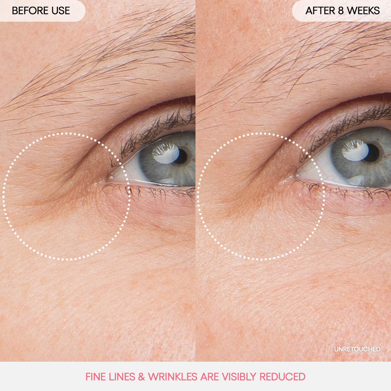 Mascarilla iluminadora de noche para ojos con efecto lifting y firmeza, con peonía y complejo de colágeno™