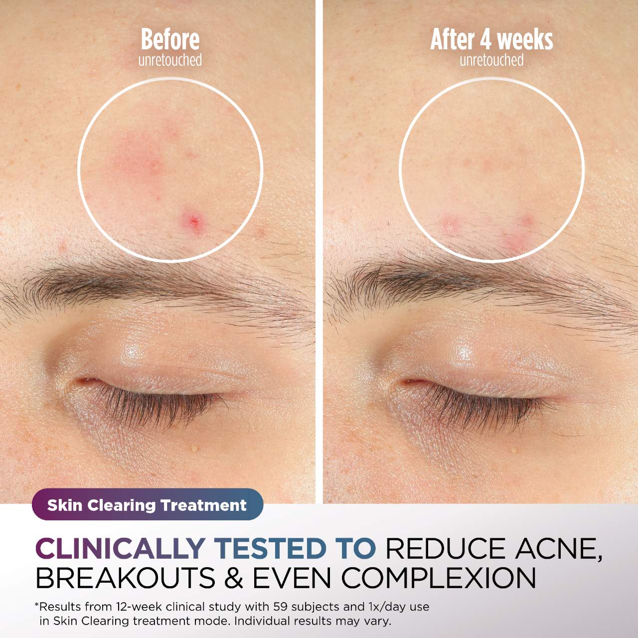 Máscara facial refrescante y LED CryoGlow™