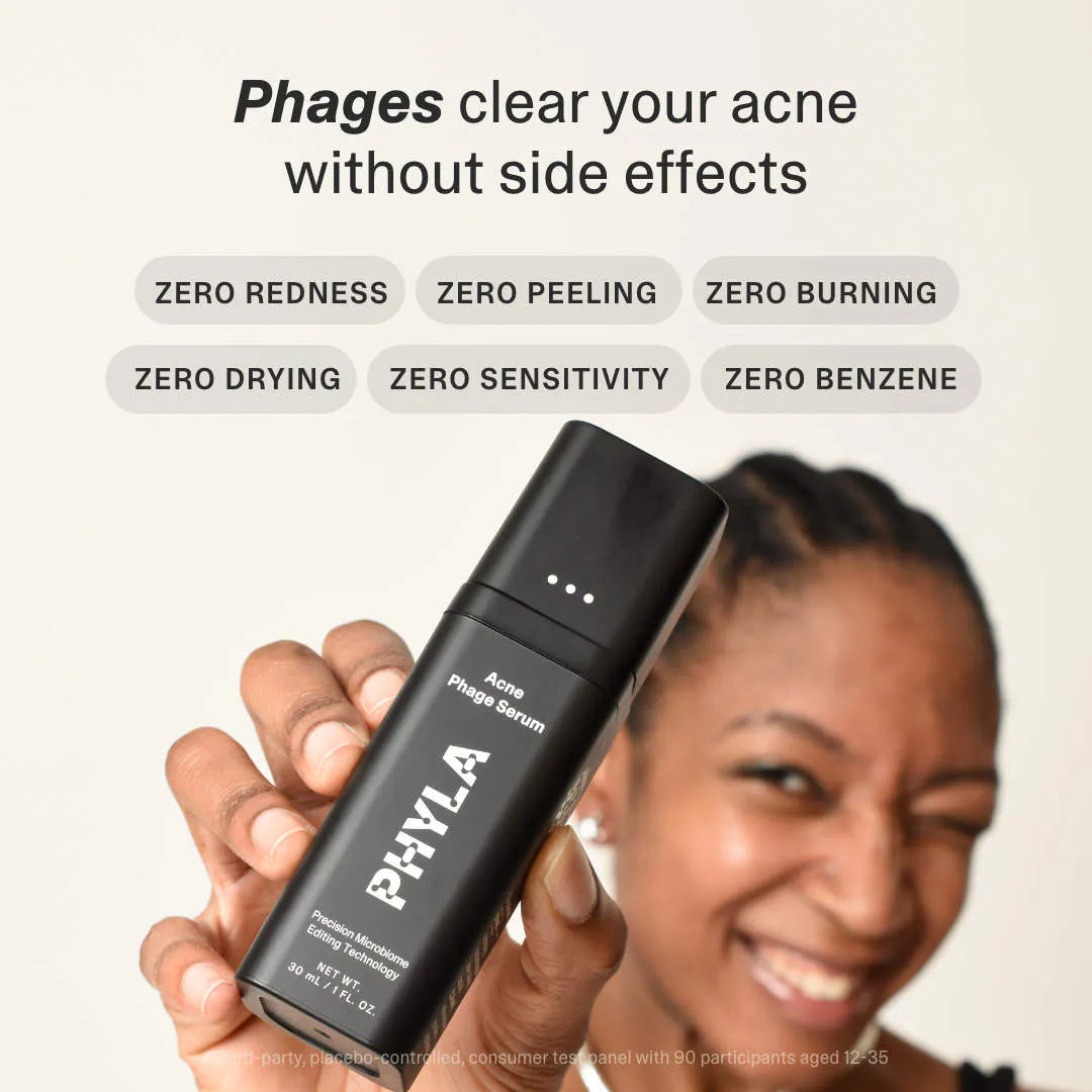 Acne Phage System
